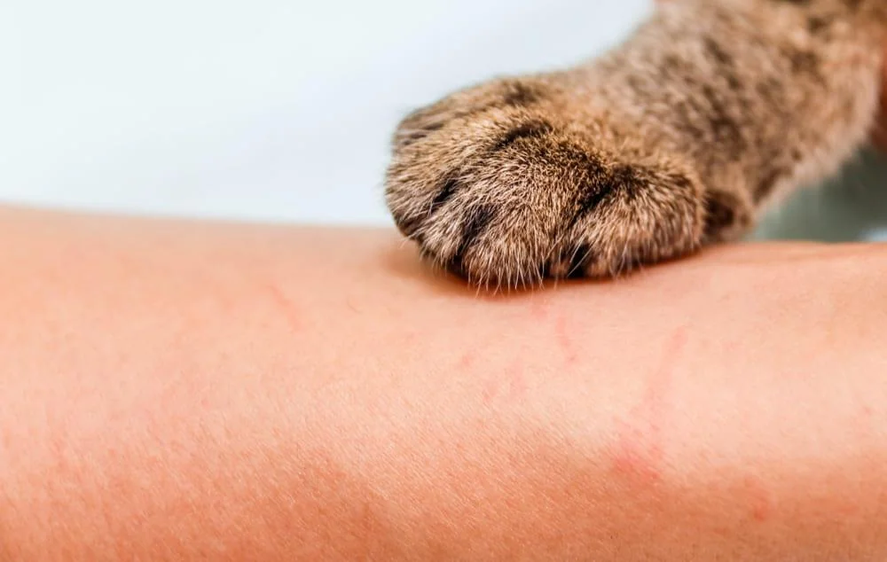 Toxoplasmoza: cauze, simptome, diagnosticare si tratament