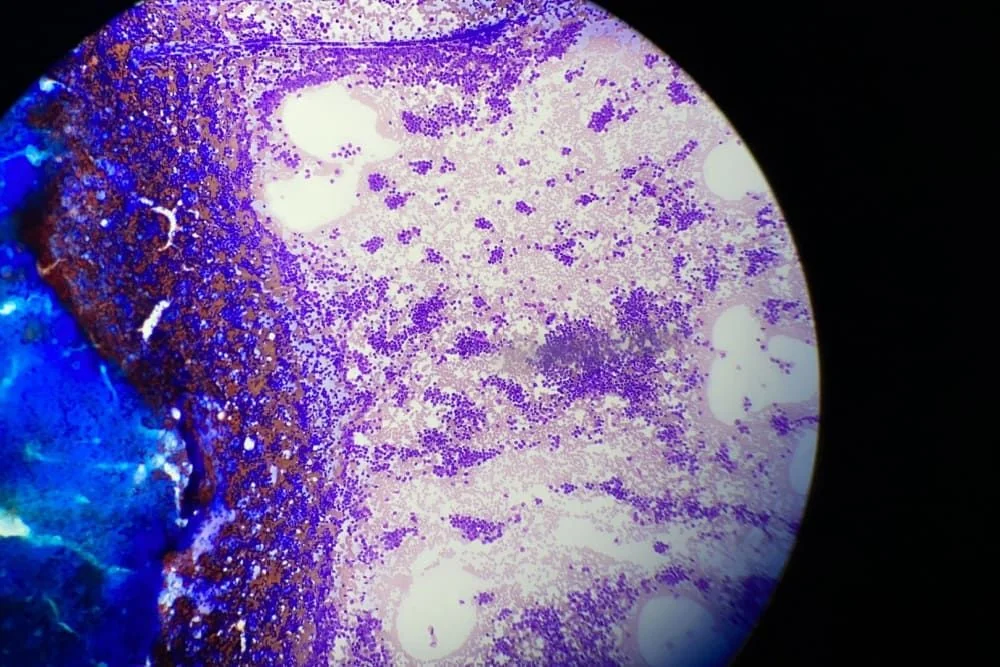 Medulograma: ce este, importanta, recomandari