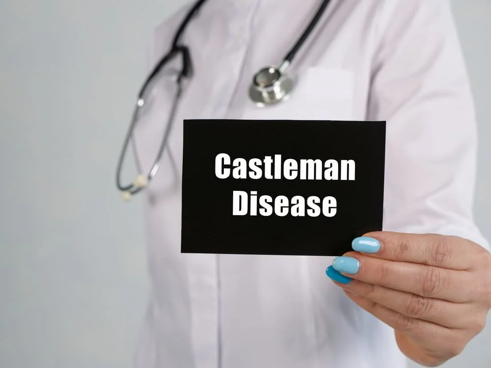 Boala Castleman