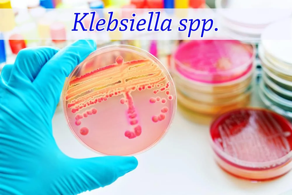 Klebsiella: ce trebuie sa stii despre aceasta bacterie?