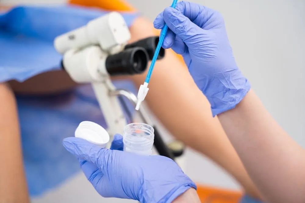 Test HPV: ce este, cand se face, beneficii