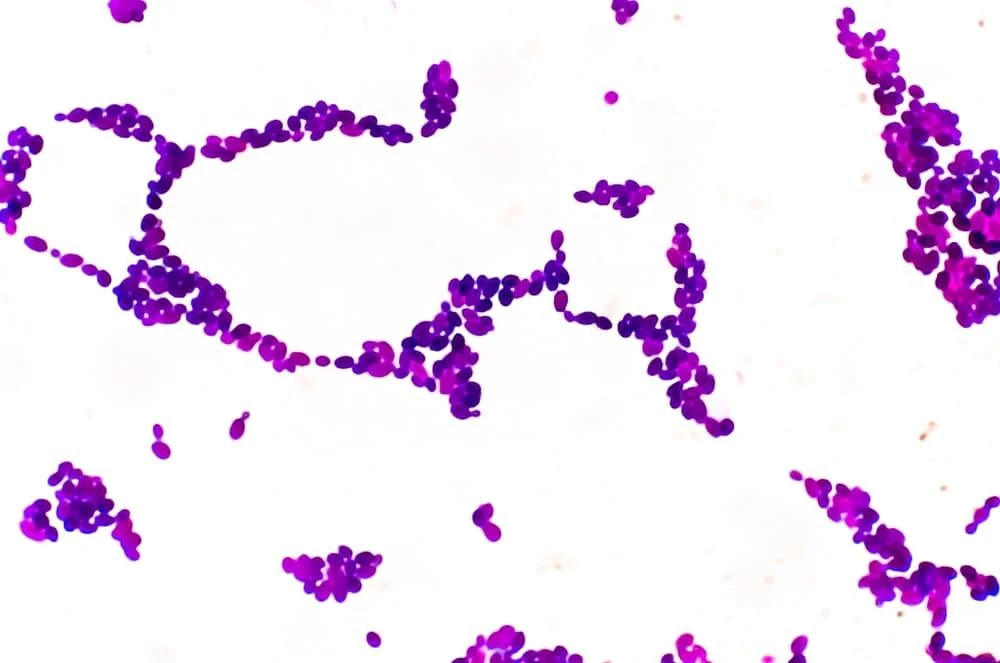 Candida intestinala: cauze, simptome, tratament