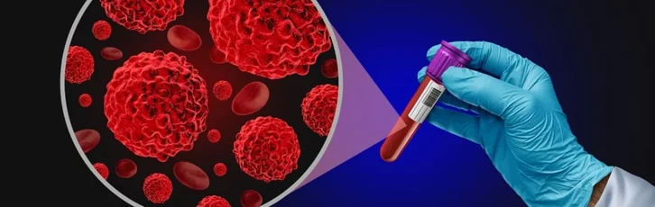 Rolul biopsiei lichide in diagnosticarea cancerului: interpretarea rezultatelor si valori normale