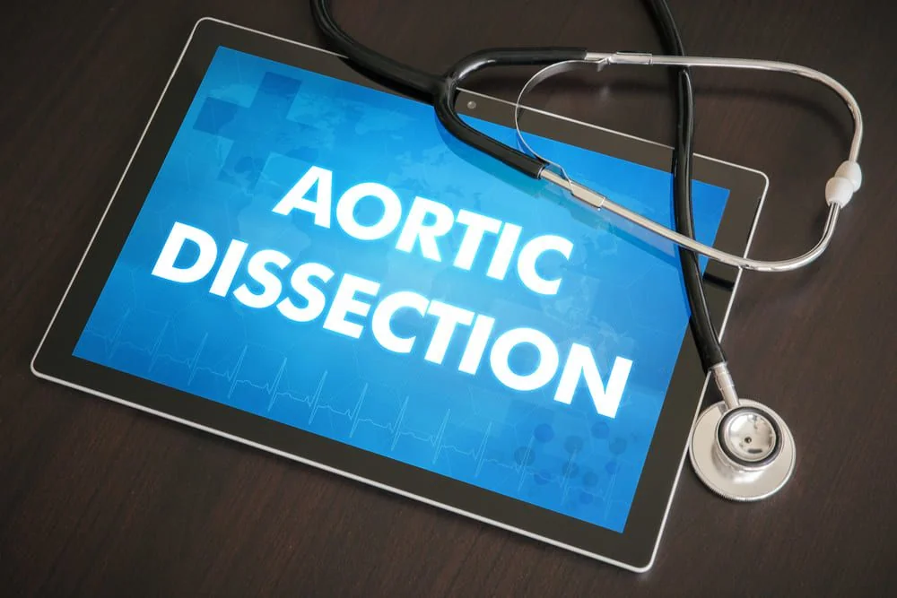 Disectie aortica: cauze, simptome, tratament