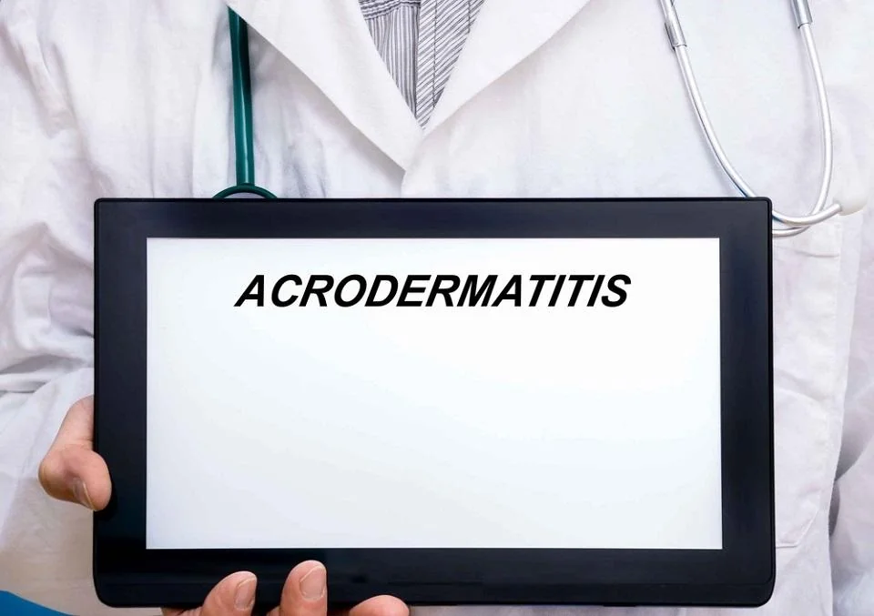 Acrodermatita: cauze, simptome, tratament