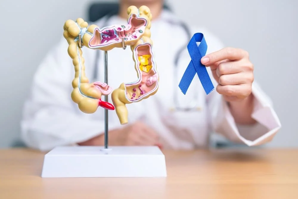 Analize cancer colon: investigatii necesare pentru depistarea cancerului de colon