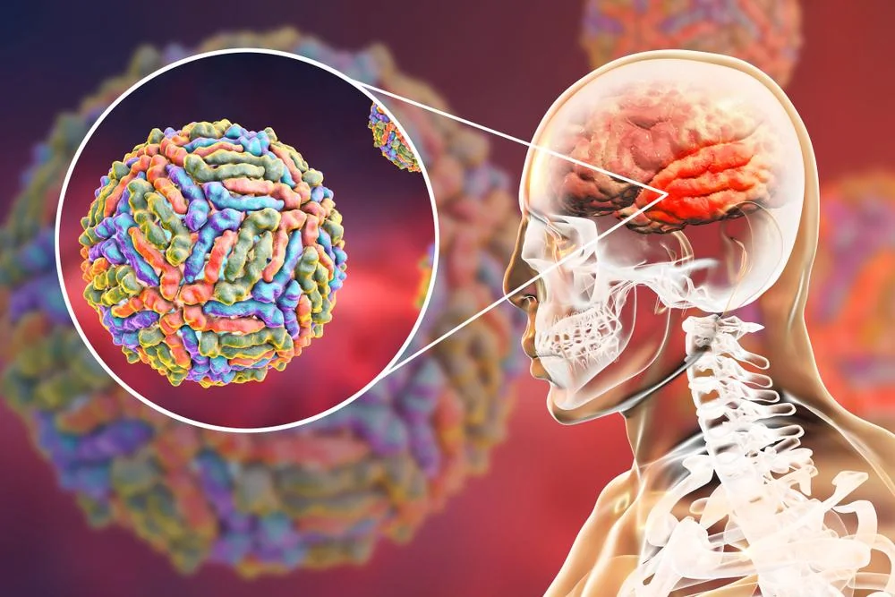 Infectia cu virusul West Nile: transmitere, manifestari si optiuni de tratament