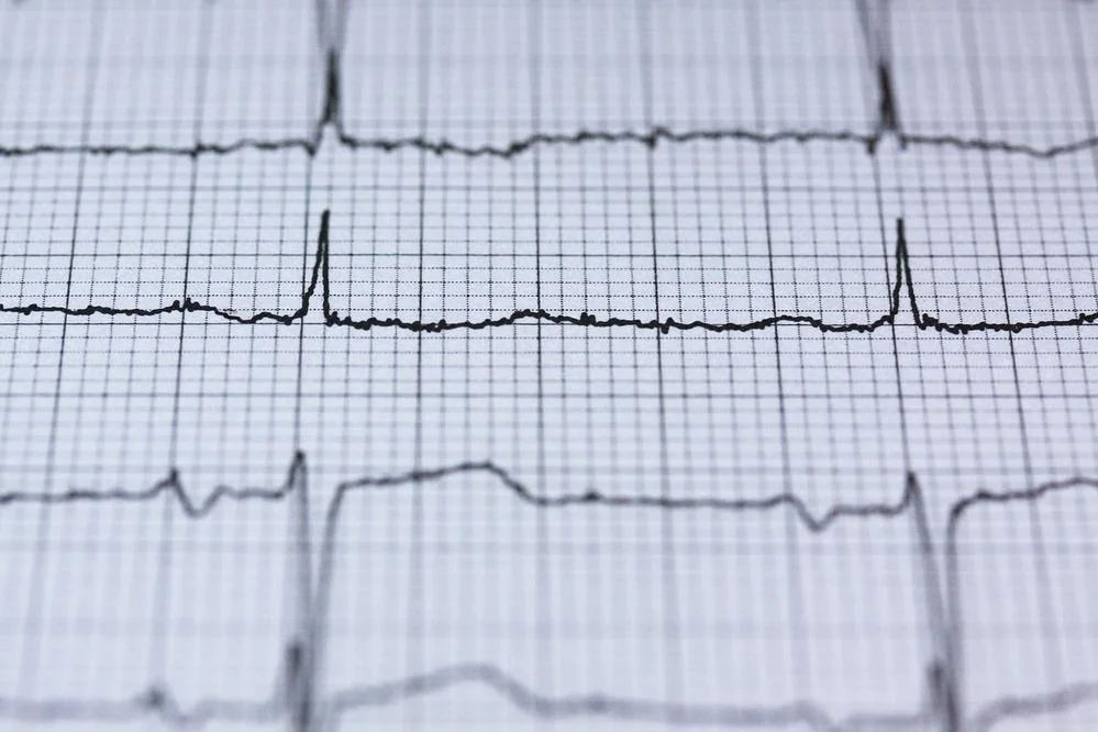 Cardiomiopatie: cauze, simptome, tratament